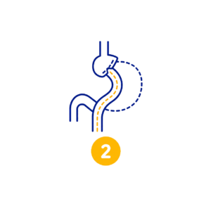 Icono Bypass Gástrico